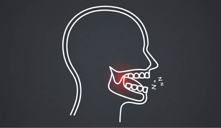 Frame 20873287601 - Tusindvis af par sover tæt igen uden snorken takket være dette mundstykke