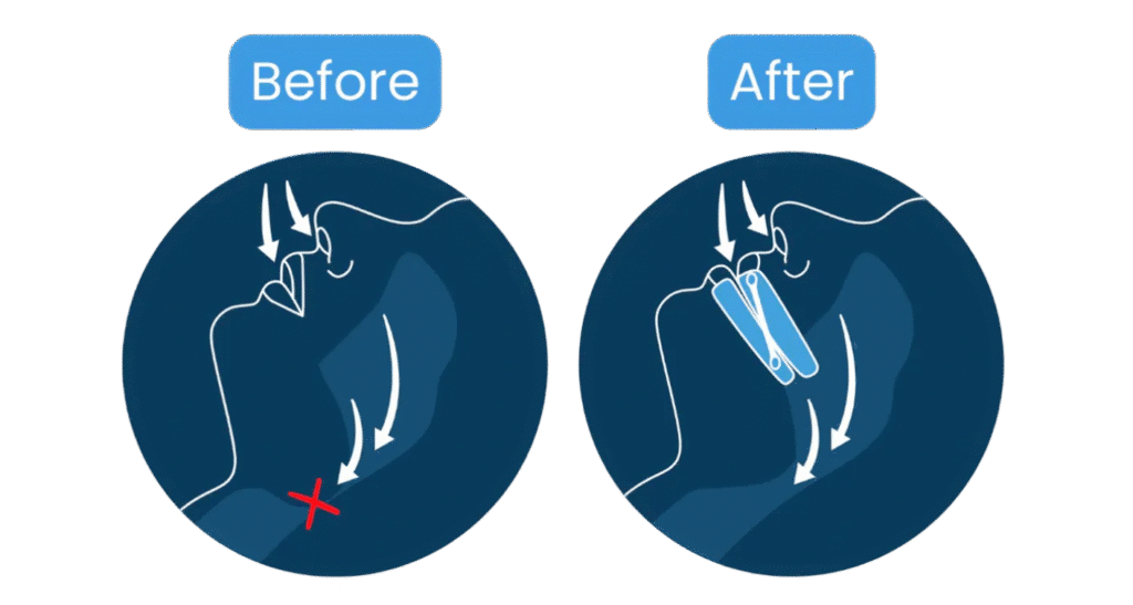 Frame 2087329074 - Er det søvnapnø eller 'bare' snorken? Brug denne 30-dages test til at finde svaret hjemme i sengen