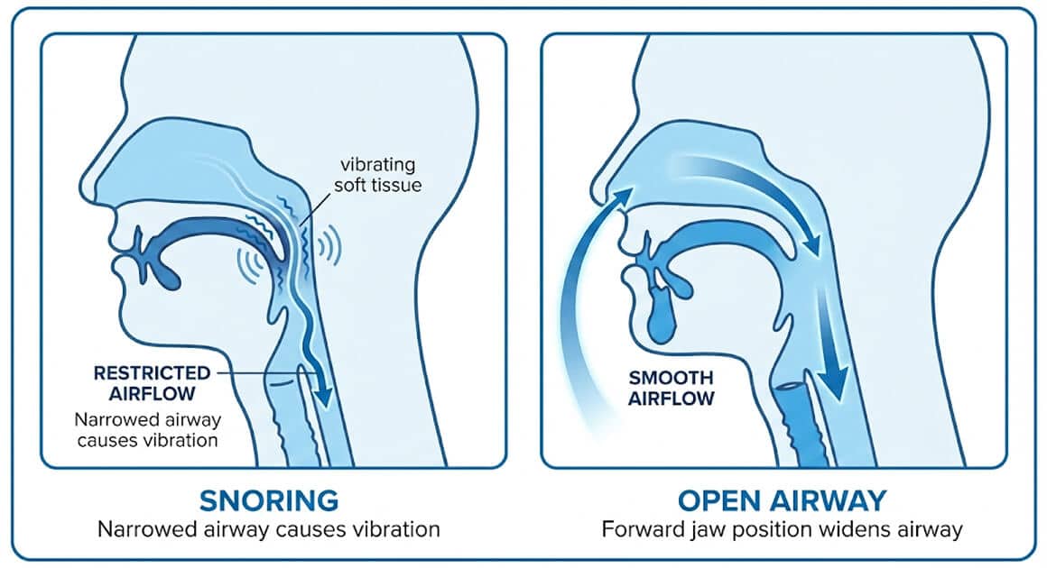 blog img 11 - "Haveslange-effekten": Hvorfor du stadig snorker, selvom du ligger på siden (og det enkle trick, som løser det)